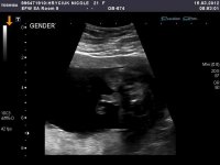 babygender2.jpg