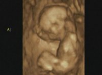 Baby A 3D.jpg