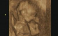 Baby B 3D.jpg