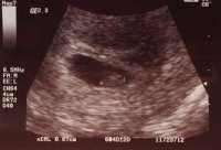 Scan.jpg