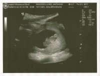 Ultrasound.jpg