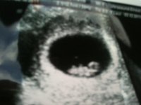 7 week scan.jpg