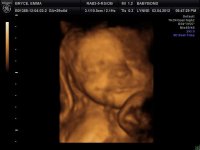 BABYBOND_19.jpg