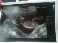 13 weeks 2 days.jpg