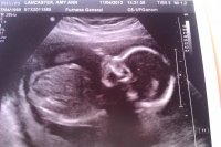 baby k 20+4 week scan.jpg