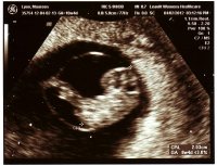 Baby_Lyon_April_2b.jpg
