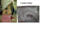 ultrasound2.jpg