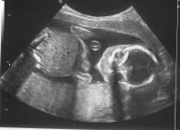 BABY Chesman 3 20 week.jpg