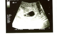 ultrasound.png