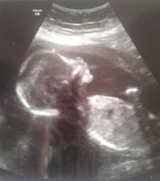 baby 1.jpg