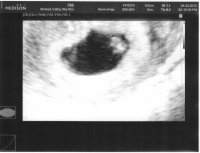 Baby Scan Week 6.jpg
