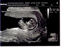Twins Ultrasound 3.jpg