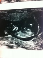 baby 12+4.jpg