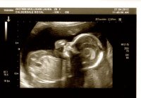 20 wk scan 2.jpg