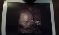 27wks3daysmiddlefinger.jpg