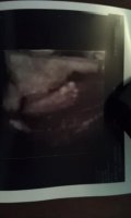 27wks3daysfoot.jpg