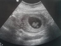 babyd2_9 weeks.jpg