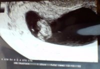 Pip 7 weeks 5 days copy.jpg