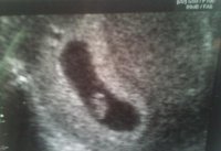 Ultrasound  7w 1d.jpg