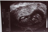 Scan 12 weeks.jpg