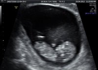 Our Babba at 11w4d 021.jpg