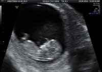 Our Babba at 11w4d 022.jpg