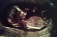 cornflake 12wks 3days.jpg
