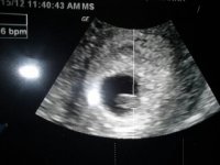 Baby 6 weeks.jpg