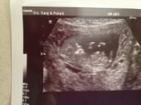12 weeks.png