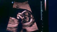 BABY LANAY2.png
