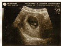 New Baby .jpg
