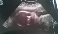 ultrasound29weeks2.jpg