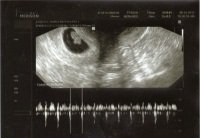 8 week scan 3.jpg