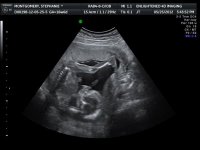 Baby profile with leg.jpg