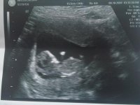 12 week scan.jpg