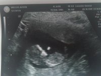 12 week scan2.jpg