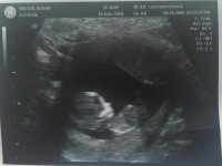 12 week scan3.jpg