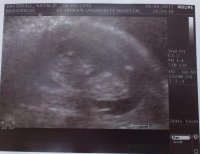 Our Little Miracle 2.jpg