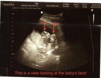 12 weeks scan 1.jpg