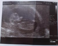 Our Little Miracle 3.jpg