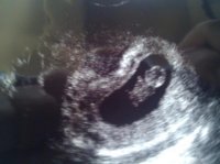9wk, 2dy.jpg