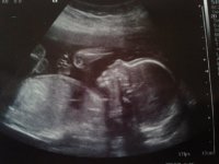 20 week scan 09.06.12.jpg