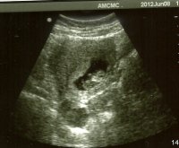 10 week ultrasound0001.jpg