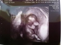 baby 12 weeks.jpg