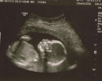babygirlscan.jpg
