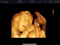 UCBABY_0034.jpg