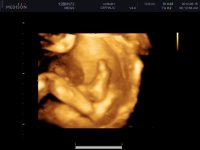 UCBABY_0060.jpg