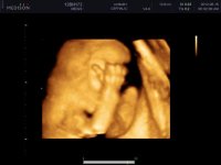 UCBABY_0045.jpg