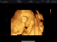 UCBABY_0046.jpg