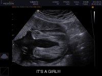 UCBABY_0001.jpg